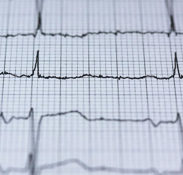 stellar node digital pulse